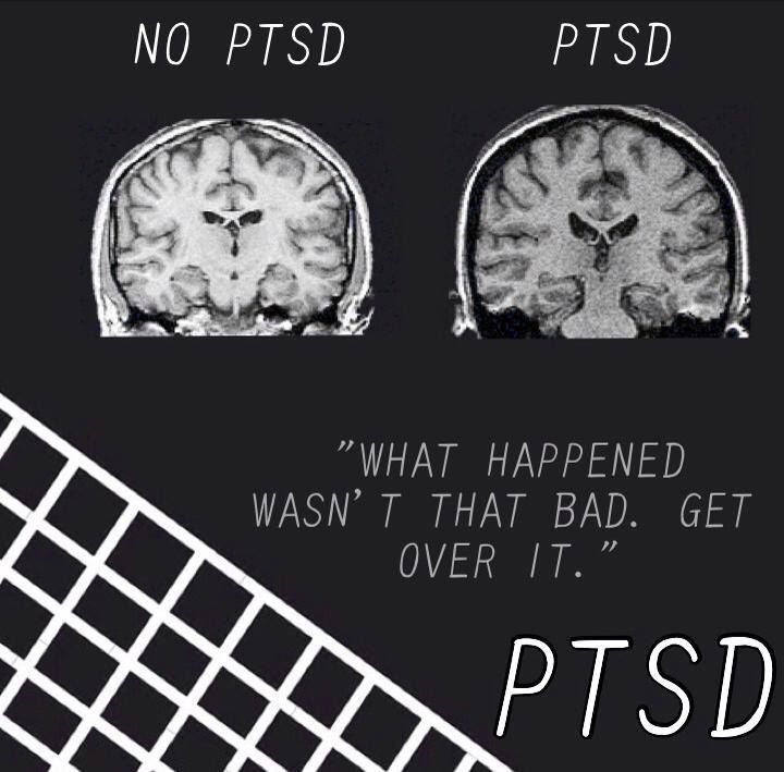 82 best PTSD