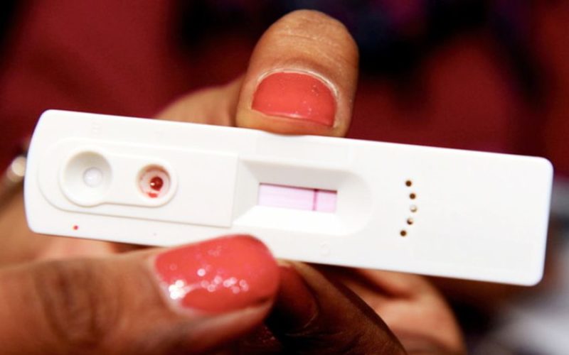 All You Need to Know About HIV Testing