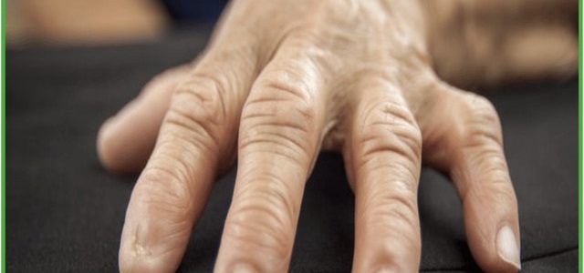 Can You Get Permanent Disability For Rheumatoid Arthritis ...