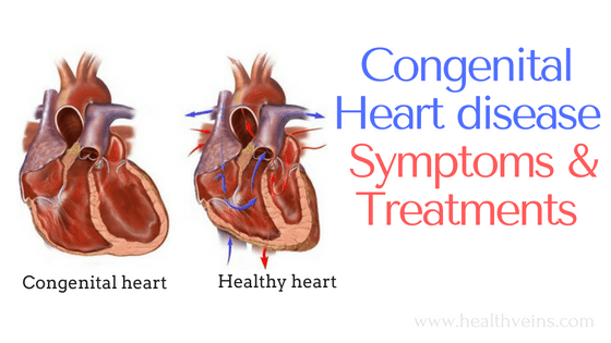 Congenital heart disease in infants symptoms and ...