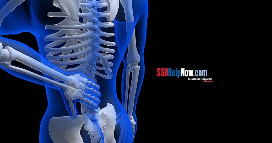 Get Spinal Stenosis Disability Benefits