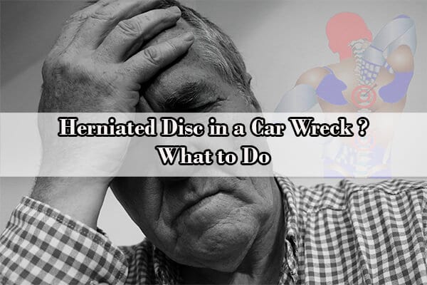 Herniated Disc in a Car Wreck? What to Do