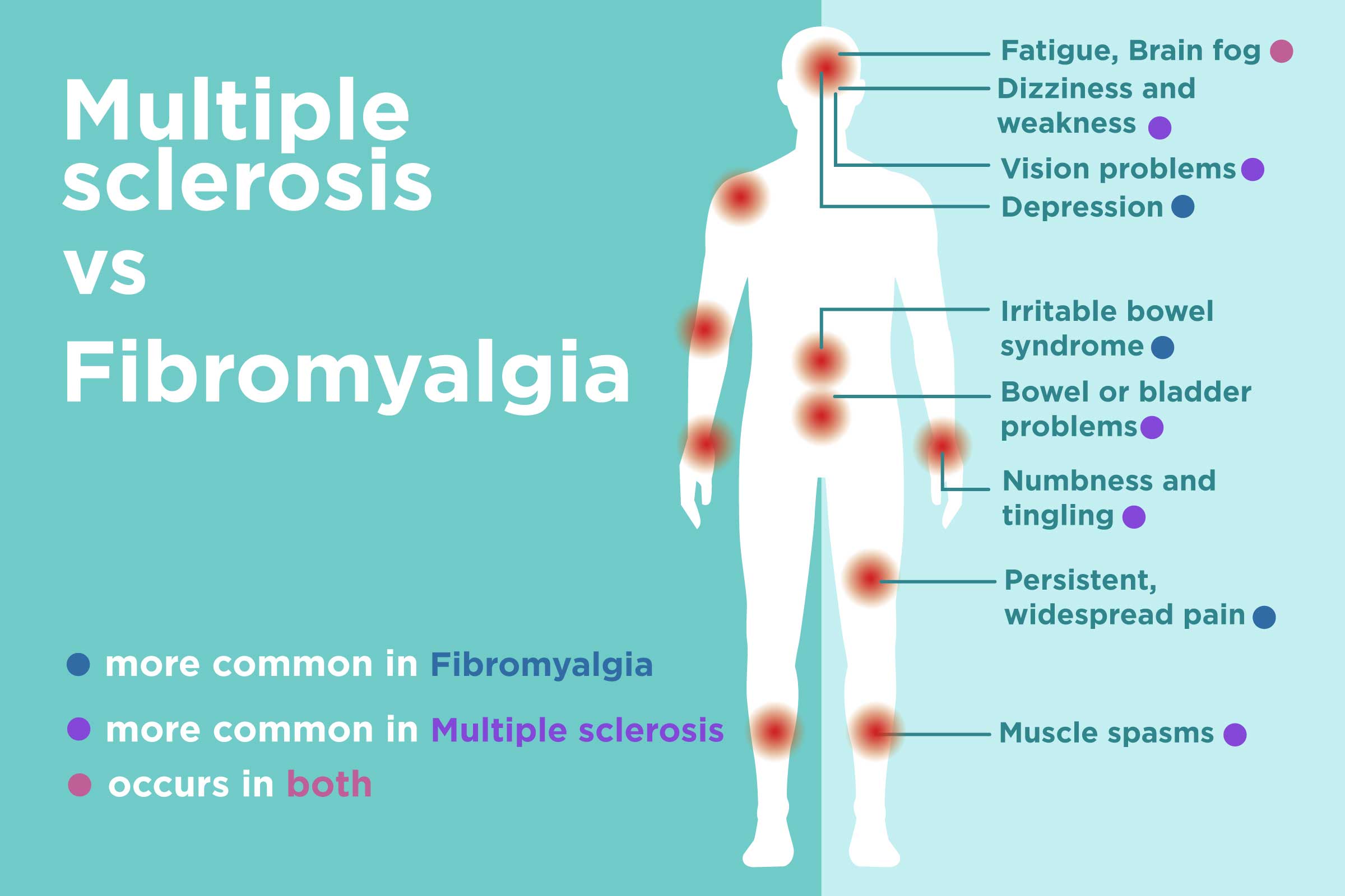 How to Apply for Disability Due to Fibromyalgia