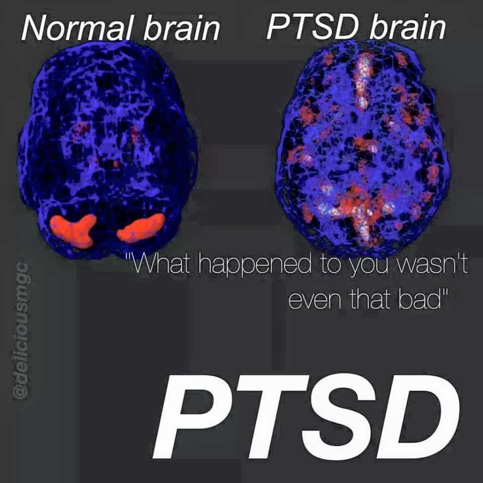 I was diagnosed with PTSD at 12 years old. Just because someone seems ...