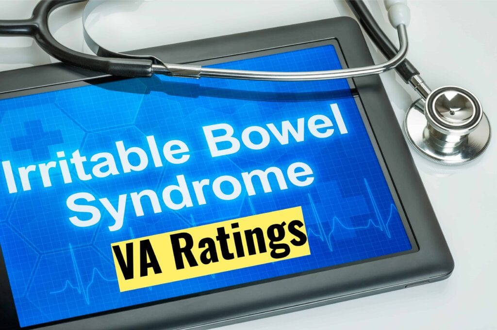 IBS VA Rating Explained  The Experts Guide
