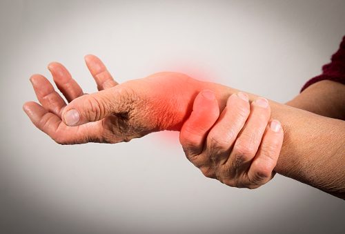 Is rheumatoid arthritis considered a disability?