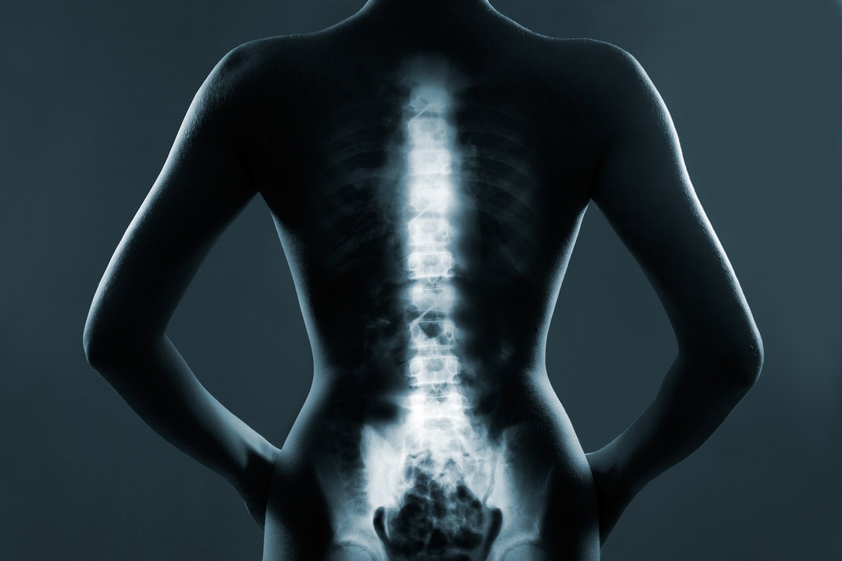 Qualifying for Disability with Spinal Disorders