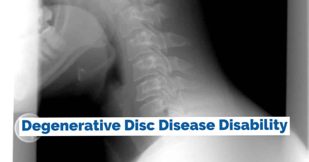 VA Disability for Degenerative Disc Disease and Related ...